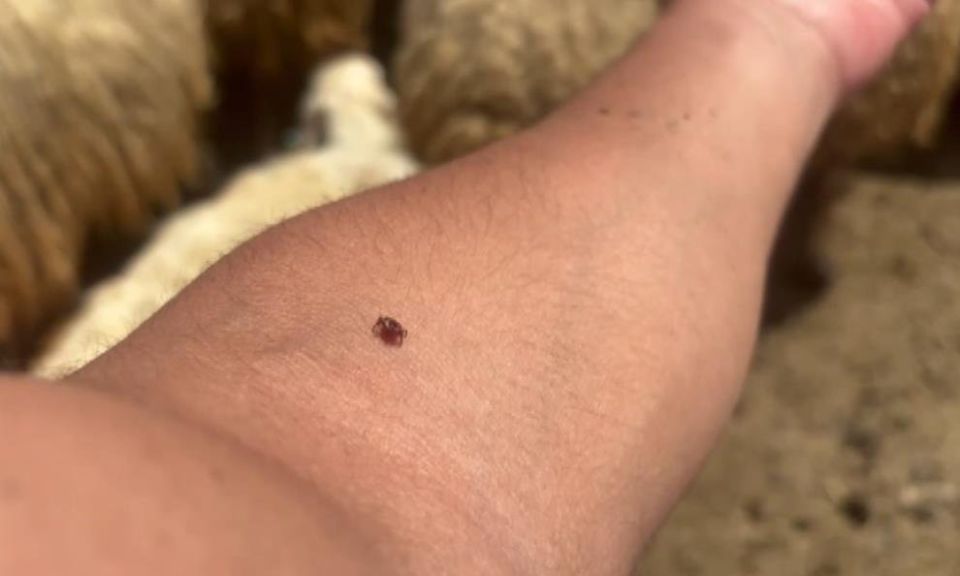 Kene tutundukça, hastalık riski artıyor: Gerekirse kendiniz çıkarın   